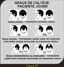 Imagem graus de Calvície em paciente jovem