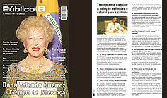 Matéria do Jornal Diário do Nordeste divulgando a técnica de Transplante de Fios Longos,trazida ao Ceará pelo Dr. Crisóstomo.