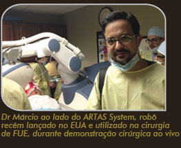 Dr. Márcio ao lado do ARTAS System - Robô usado na cirurgia de FUE